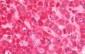 CS / Citrate Synthase Antibody